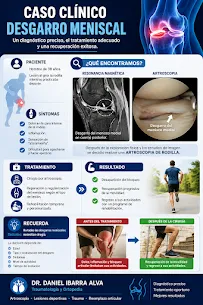 Caso clínico: desgarro meniscal